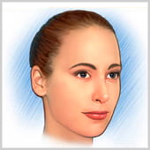 Injections de toxine botulinique pour traiter les rides entre les sourcils
