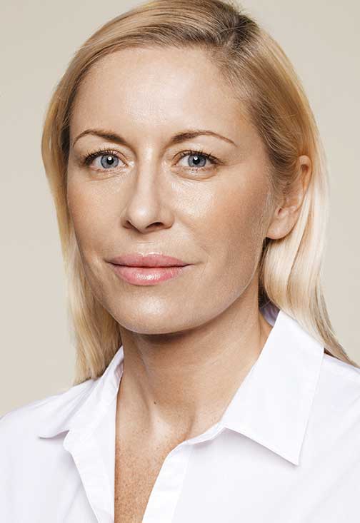 injections Skinboosters - Après