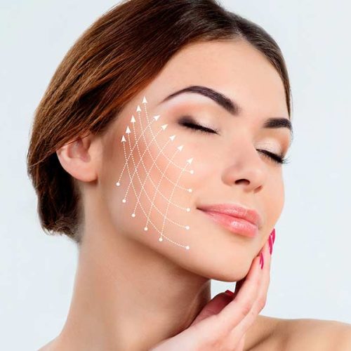 lifting avec injection